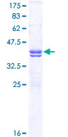 ab158013 on a 12.5% SDS-PAGE stained with Coomassie Blue.