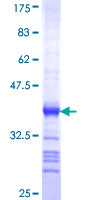 ab160262 on a 12.5% SDS-PAGE stained with Coomassie Blue.