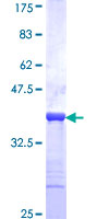 ab152967 on a 12.5% SDS-PAGE stained with Coomassie Blue.