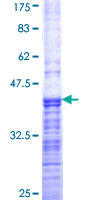 ab160965 on a 12.5% SDS-PAGE stained with Coomassie Blue.
