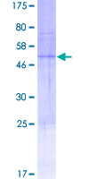 ab163704 on a 12.5% SDS-PAGE stained with Coomassie Blue.
