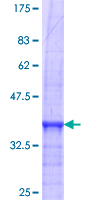 ab114596 analysed on a 12.5% SDS-PAGE gel stained with Coomassie Blue.