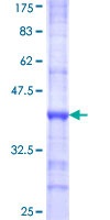 12.5% SDS-PAGE stained with Coomassie Blue.