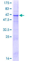 ab164641 on a 12.5% SDS-PAGE stained with Coomassie Blue.