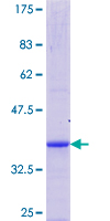 ab164642 on a 12.5% SDS-PAGE stained with Coomassie Blue.