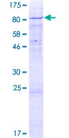 ab158037 on a 12.5% SDS-PAGE stained with Coomassie Blue.