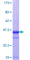 ab158094 on a 12.5% SDS-PAGE stained with Coomassie Blue.
