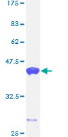 ab162670 on a 12.5% SDS-PAGE stained with Coomassie Blue.