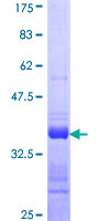 ab162671 on a 12.5% SDS-PAGE stained with Coomassie Blue.