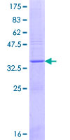 ab164901 on a 12.5% SDS-PAGE stained with Coomassie Blue.