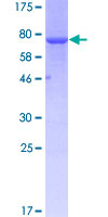 ab158035 on a 12.5% SDS-PAGE stained with Coomassie Blue.