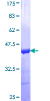 ab158036 on a 12.5% SDS-PAGE stained with Coomassie Blue.