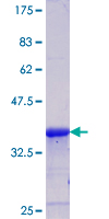 ab163489 on a 12.5% SDS-PAGE stained with Coomassie Blue.