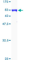ab163512 on a 12.5% SDS-PAGE stained with Coomassie Blue.