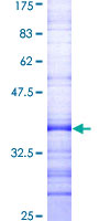 ab163513 on a 12.5% SDS-PAGE stained with Coomassie Blue.