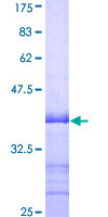 ab160081 on a 12.5% SDS-PAGE stained with Coomassie Blue.