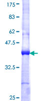 ab158020 on a 12.5% SDS-PAGE stained with Coomassie Blue.