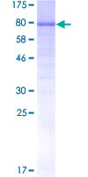 ab164537 on a 12.5% SDS-PAGE stained with Coomassie Blue.