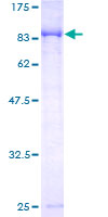 ab163956 on a 12.5% SDS-PAGE stained with Coomassie Blue.