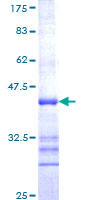 ab114206 analysed on a 12.5% SDS-PAGE gel stained with Coomassie Blue.