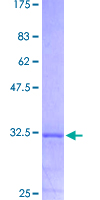 12.5% SDS-PAGE showing ab152290 stained with Coomassie Blue