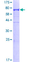 ab161016 on a 12.5% SDS-PAGE stained with Coomassie Blue.