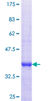 ab160626 on a 12.5% SDS-PAGE stained with Coomassie Blue.