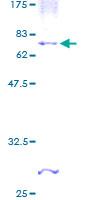 ab160853 on a 12.5% SDS-PAGE stained with Coomassie Blue.