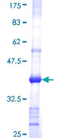 ab160854 on a 12.5% SDS-PAGE stained with Coomassie Blue.