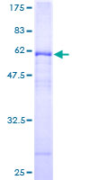 ab158007 on a 12.5% SDS-PAGE stained with Coomassie Blue.
