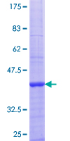 ab158008 on a 12.5% SDS-PAGE stained with Coomassie Blue.