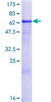 ab161725 on a 12.5% SDS-PAGE stained with Coomassie Blue.