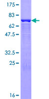 ab158187 on a 12.5% SDS-PAGE stained with Coomassie Blue.