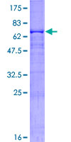 ab158190 on a 12.5% SDS-PAGE stained with Coomassie Blue.