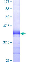 ab158191 on a 12.5% SDS-PAGE stained with Coomassie Blue.
