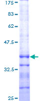 ab153305 on a 12.5% SDS-PAGE stained with Coomassie Blue.