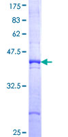ab164634 on a 12.5% SDS-PAGE stained with Coomassie Blue.