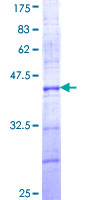 ab161468 on a 12.5% SDS-PAGE stained with Coomassie Blue.