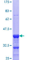 ab161469 on a 12.5% SDS-PAGE stained with Coomassie Blue.