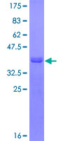 ab163797 on a 12.5% SDS-PAGE stained with Coomassie Blue.