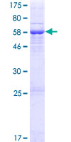 ab163198 on a 12.5% SDS-PAGE stained with Coomassie Blue.