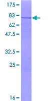ab161754 on a 12.5% SDS-PAGE stained with Coomassie Blue.