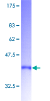 ab160570 on a 12.5% SDS-PAGE stained with Coomassie Blue.