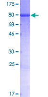 ab164998 on a 12.5% SDS-PAGE stained with Coomassie Blue.