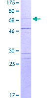 ab158029 on a 12.5% SDS-PAGE stained with Coomassie Blue.