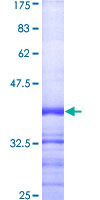 ab158030 on a 12.5% SDS-PAGE stained with Coomassie Blue.
