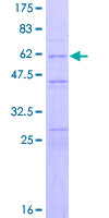 ab158031 on a 12.5% SDS-PAGE stained with Coomassie Blue.