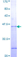 ab158034 on a 12.5% SDS-PAGE stained with Coomassie Blue.