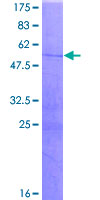 ab158233 on a 12.5% SDS-PAGE stained with Coomassie Blue.