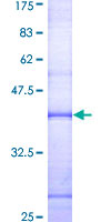 ab158234 on a 12.5% SDS-PAGE stained with Coomassie Blue.